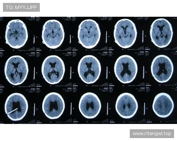 尤文官方确认凯利股二头肌轻伤预计十天后复查恢复情况